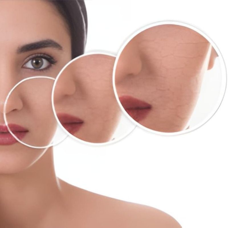 শুষ্ক ত্বক আর পানিশূন্য ত্বকের