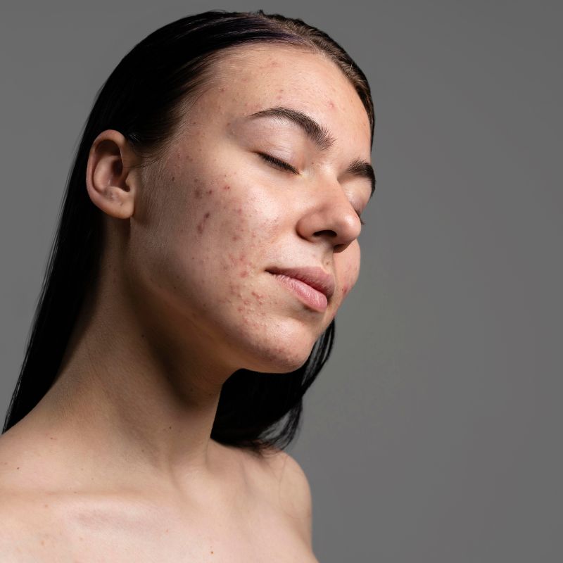 দাগ বা স্কার দূর করা