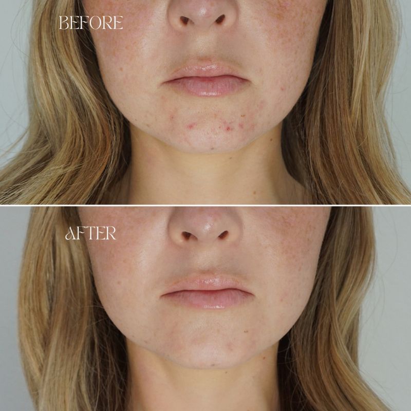 সেন্সিটিভ স্কিনের জন্য নিরাপদ প্রাকৃতিক উপায়